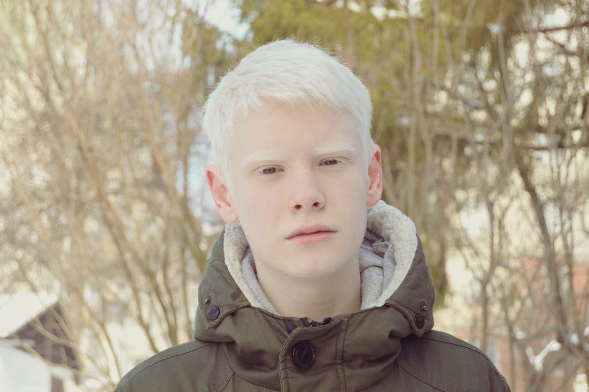 Albino